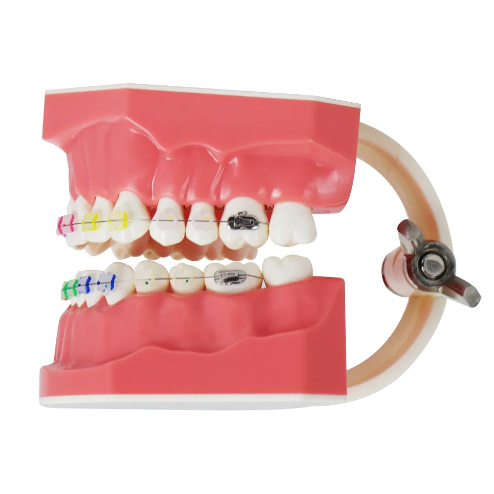 iDENTical Orthodontic Patient Education Model (Ceramic) - M3002