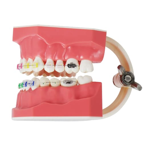 iDENTical Orthodontic Patient Education Model (Ceramic) - M3002	