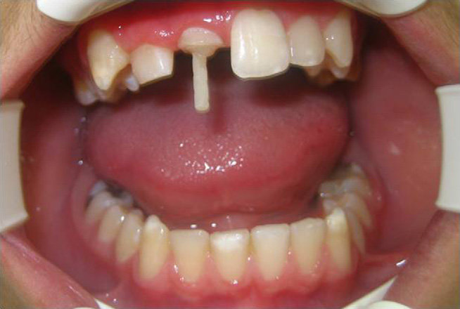 Medicept Dental Self Post