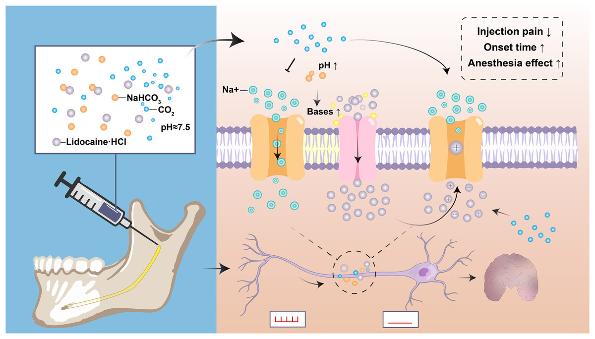 Vishal Dentocare Ligno Ad Local Anaesthetic 30ml (Pack of 10)