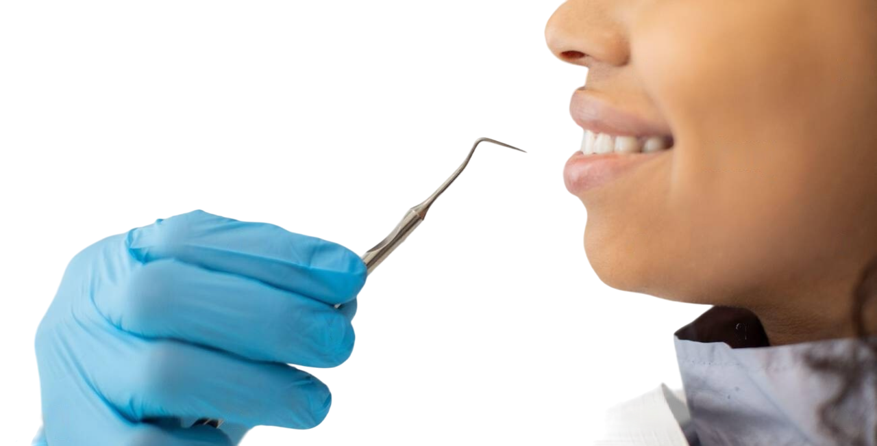 GDC Single End Probe -3 (Exs6xl)