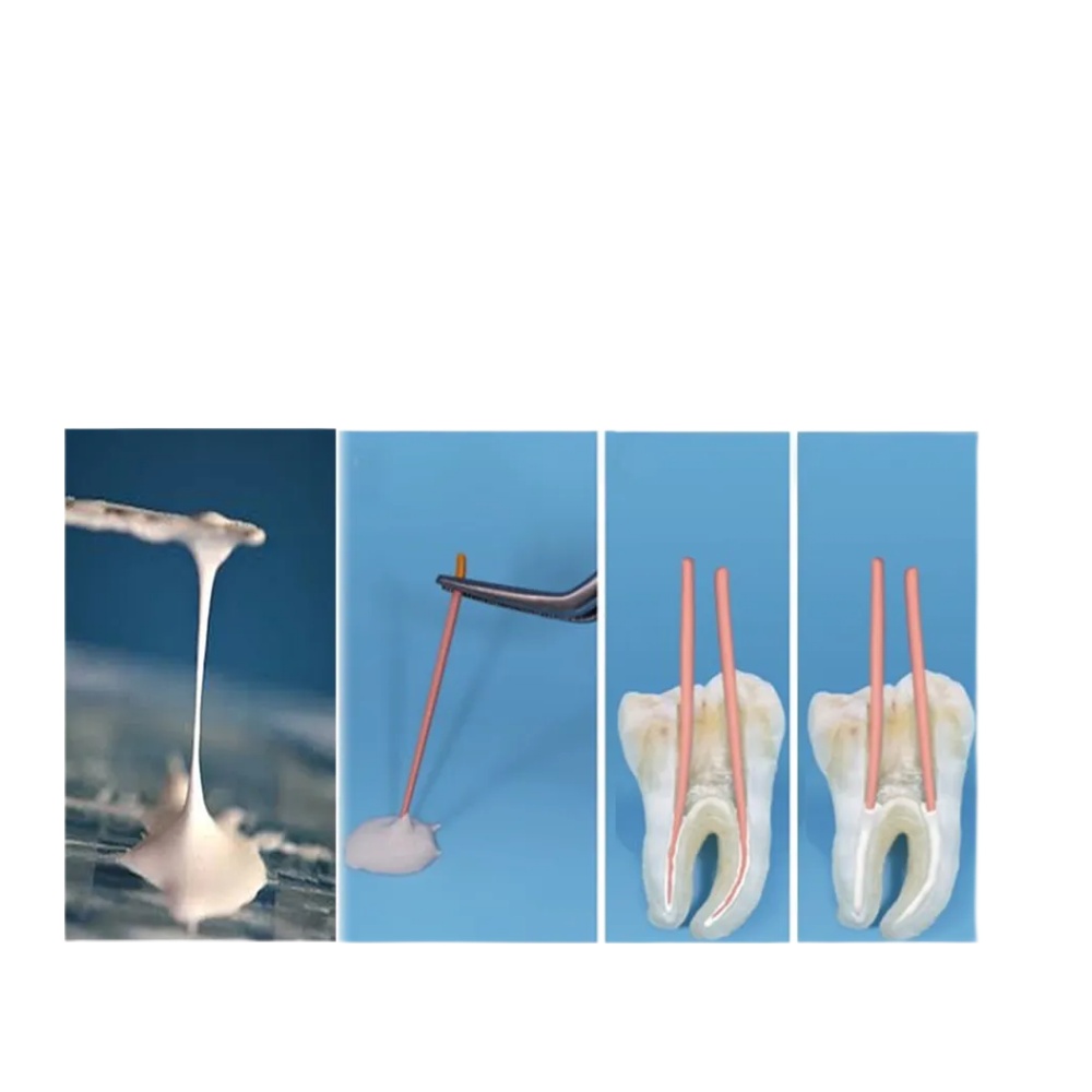 Prime Dental RC Seal