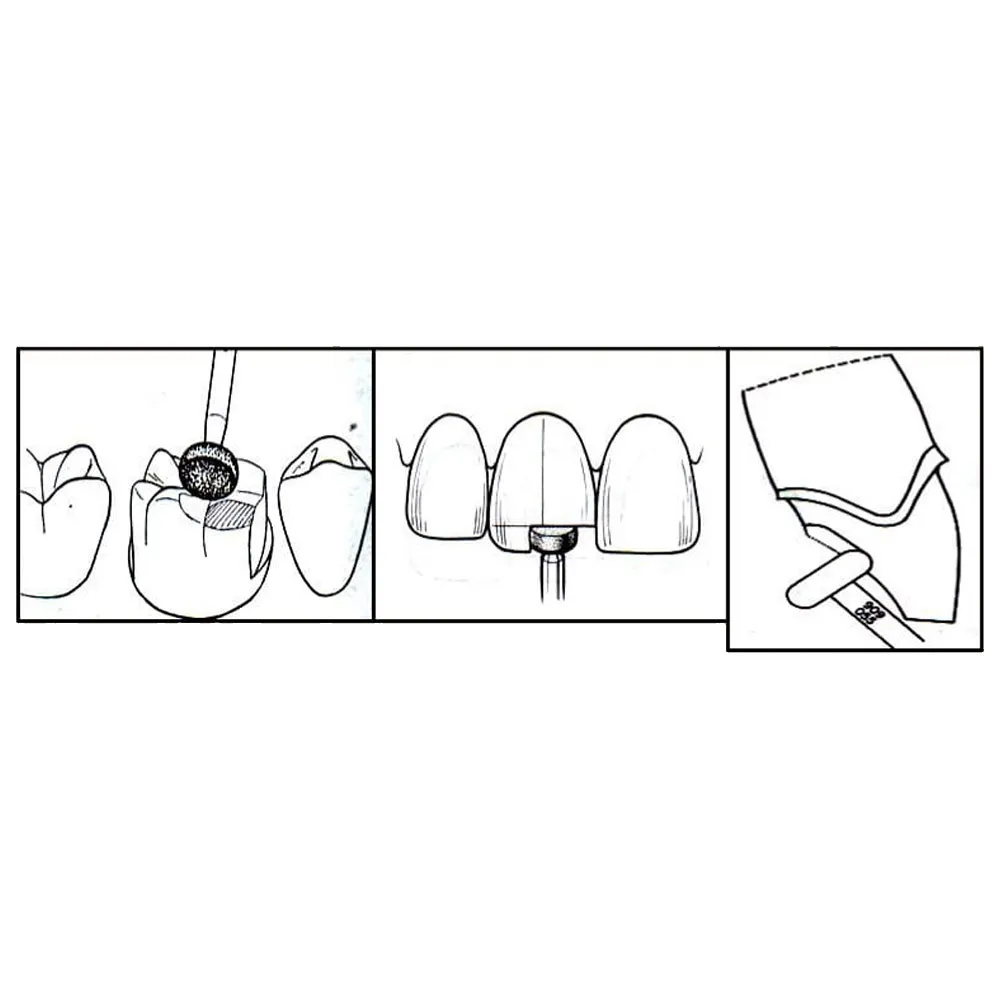 NewDiamond Flat Lathe Diamond Burs -FL (Pack of 3)