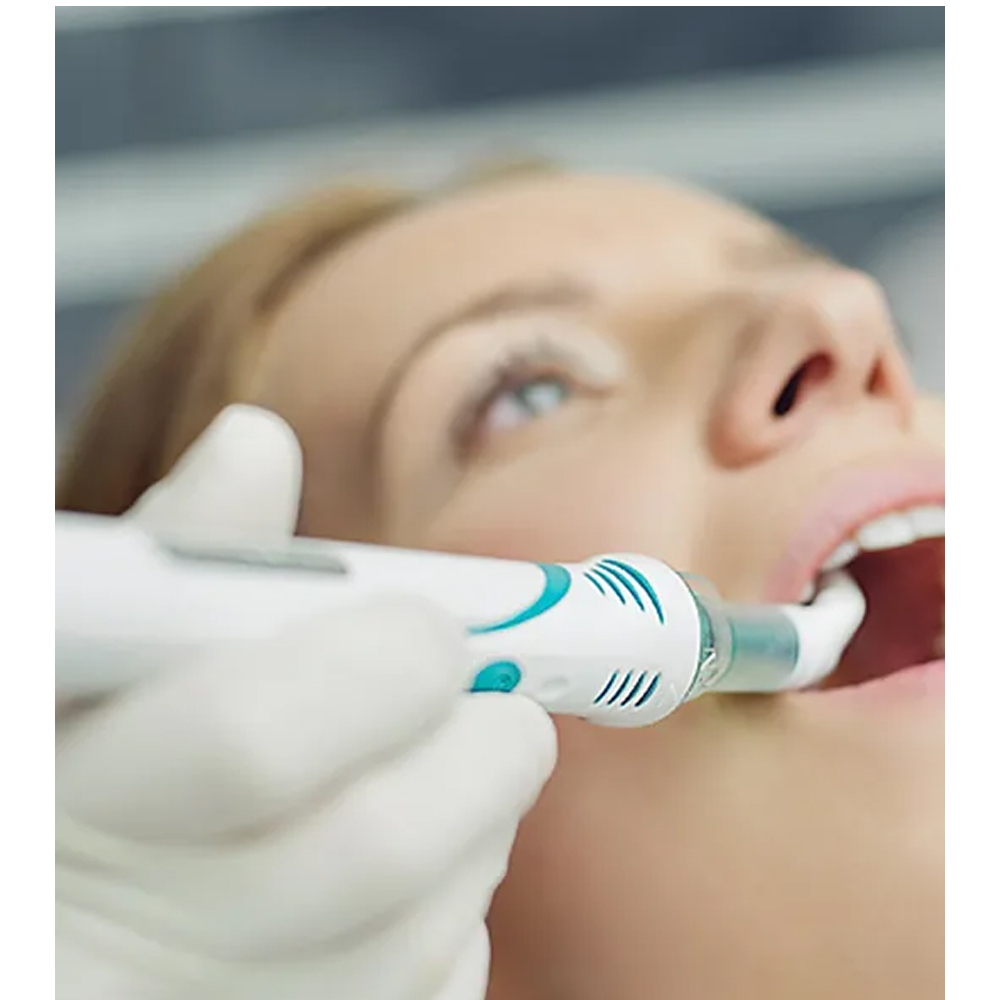 Flexi Tips For DentalVibe Injection Comfort System (GEN4TIP) - Pack of 50