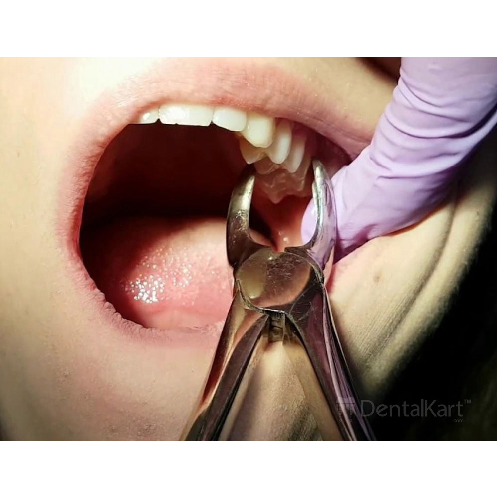 GDC Extraction Forceps Upper Molar Left Standard (FX18S)