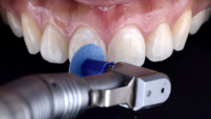 Shofu Direct Dia Diamond Polishing Paste