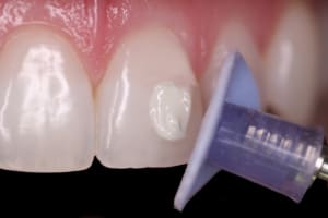 Shofu Direct Dia Diamond Polishing Paste