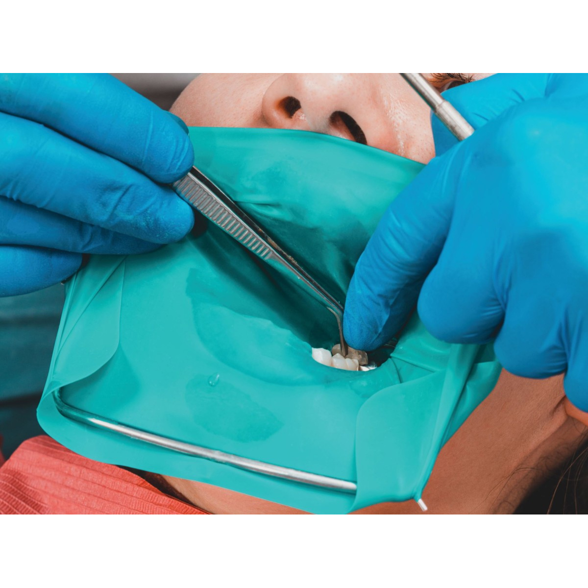 GDC Rubber Dam Frame Large (Rdaf6)