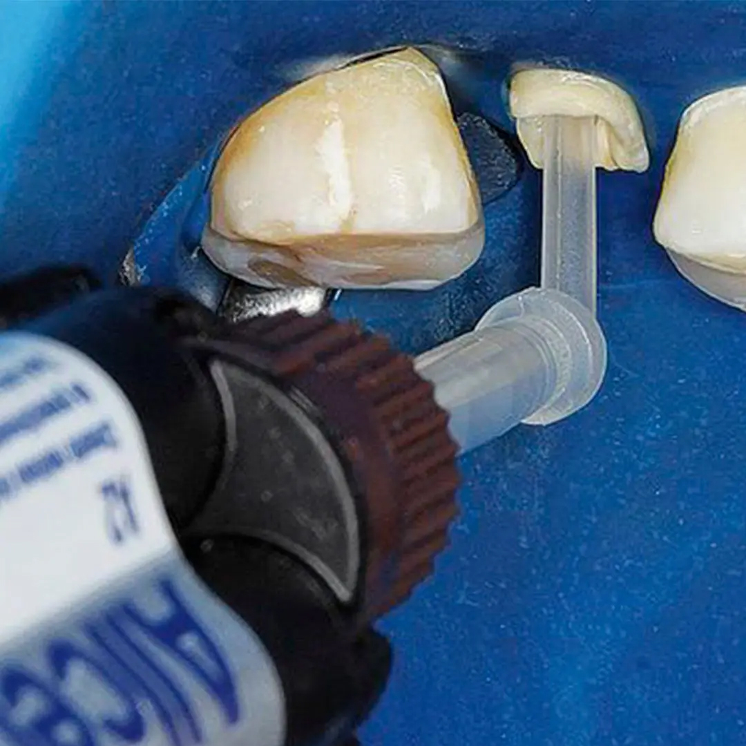 FGM Allcem Core Dual Cure Resin Cement