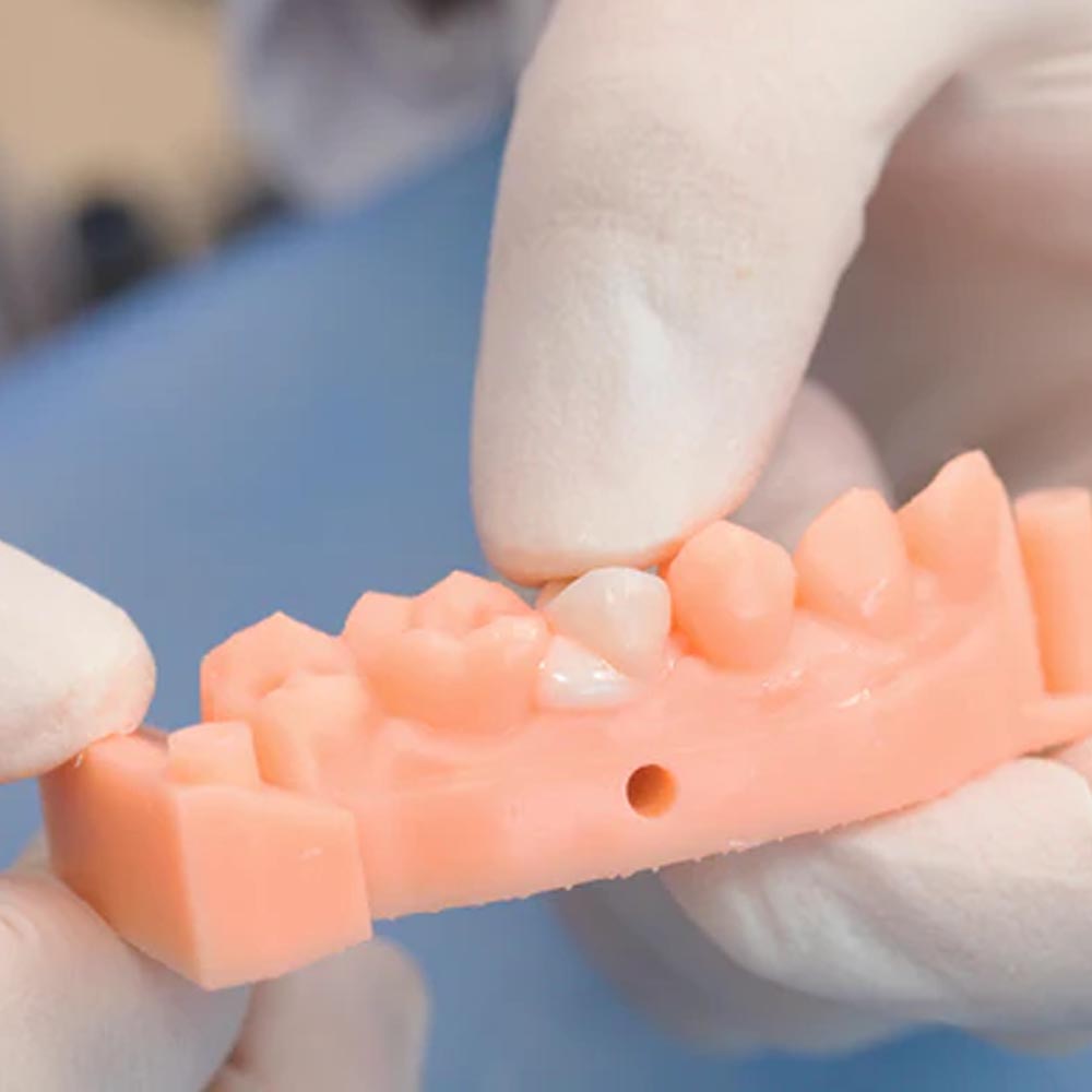 Vincismile TopCEM Dual Cure Resin Cement