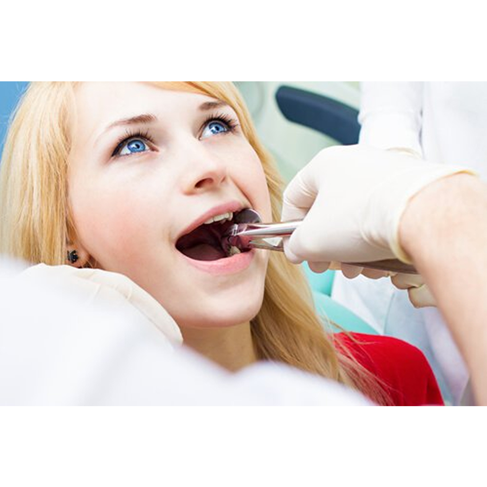 GDC Extraction Forceps Lower Roots - 31 Standard (FX31S)