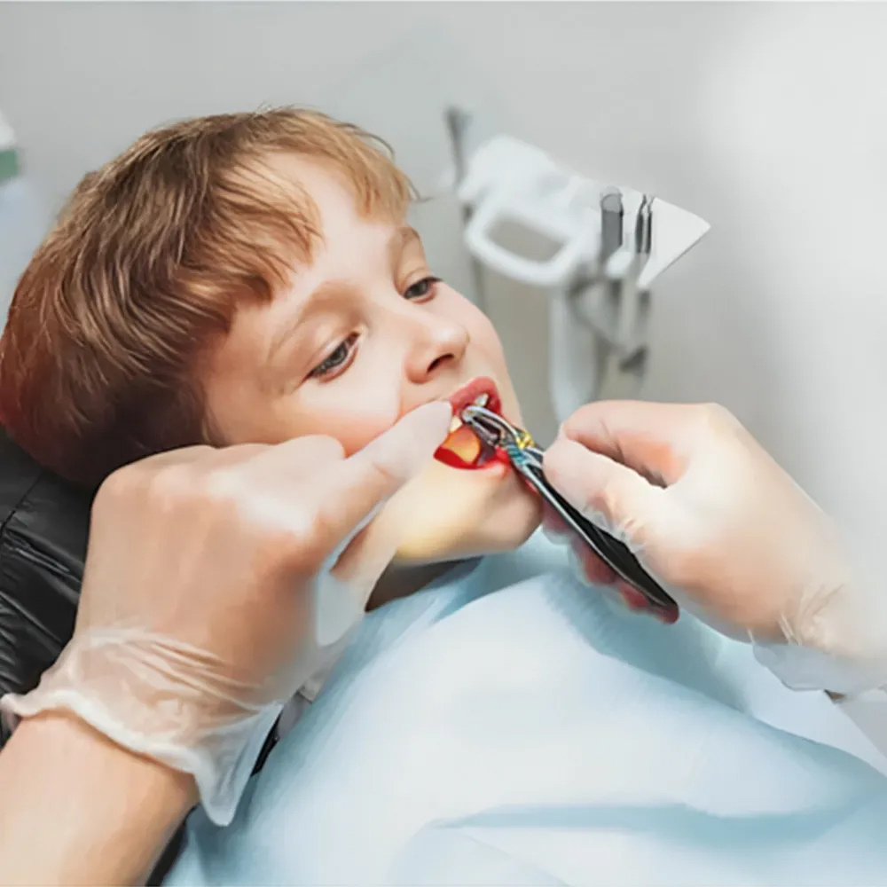 GDC Extraction Forcep Upper Anterior Pedo Standard (FX5CS)