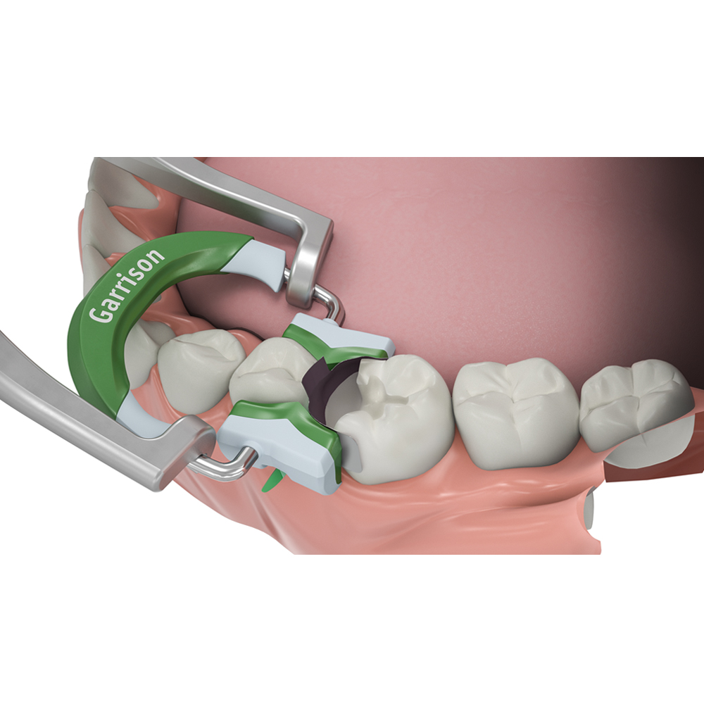 Garrison Dental Composi-Tight 3D Sectional Matrix System Kit