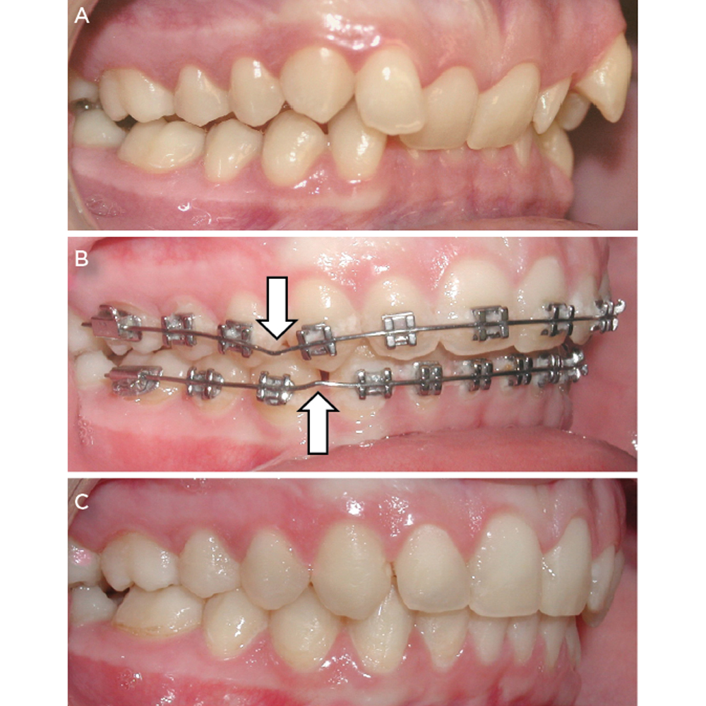 GDC V Bending Plier (3000/321)