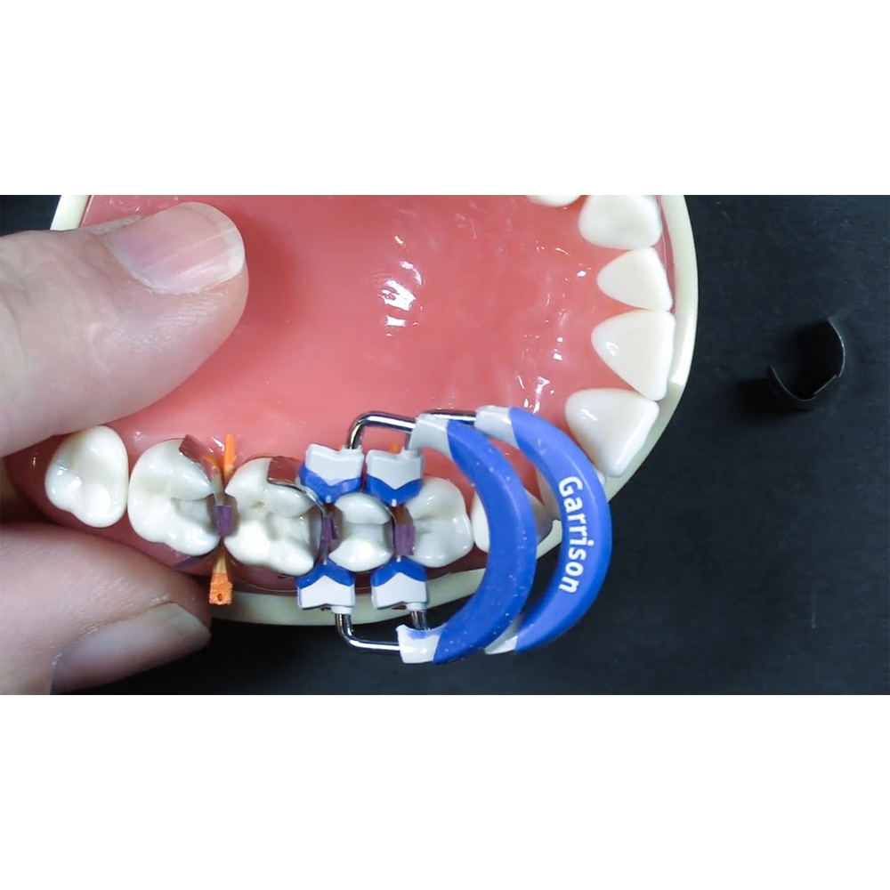 Garrison Dental Composi-Tight 3D Sectional Matrix System Kit