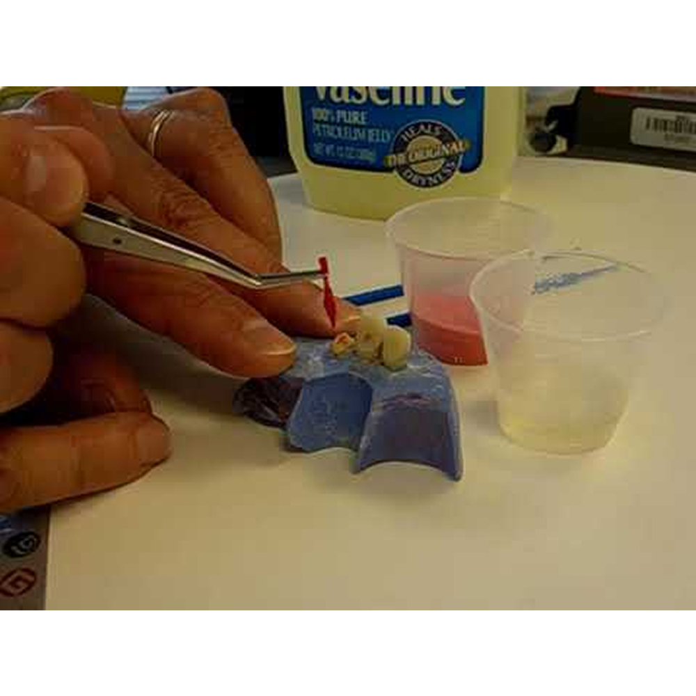 GC Pattern Resin 1-1 Package