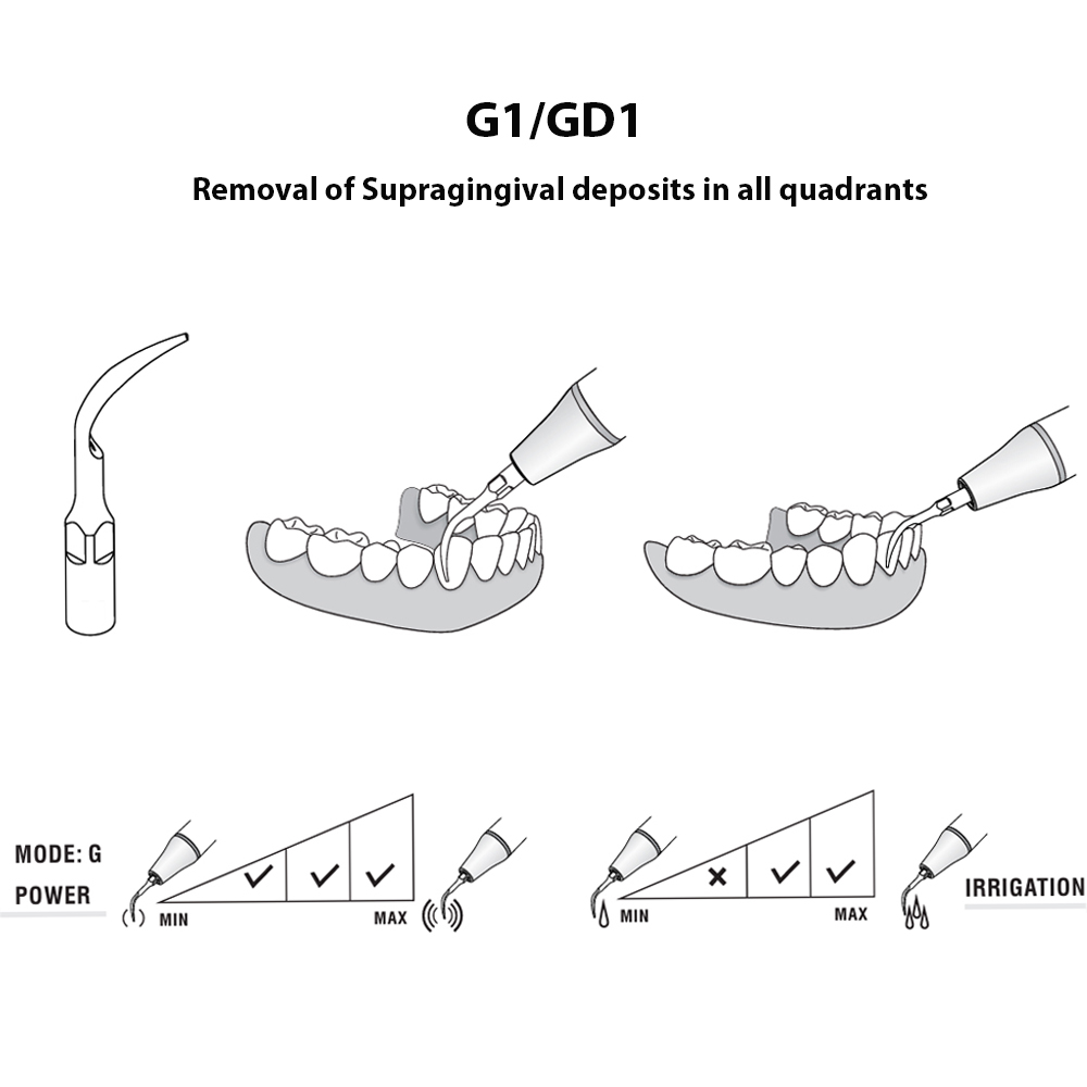 Woodpecker Scaler Tip GD1 for DTE & Satelec Scalers