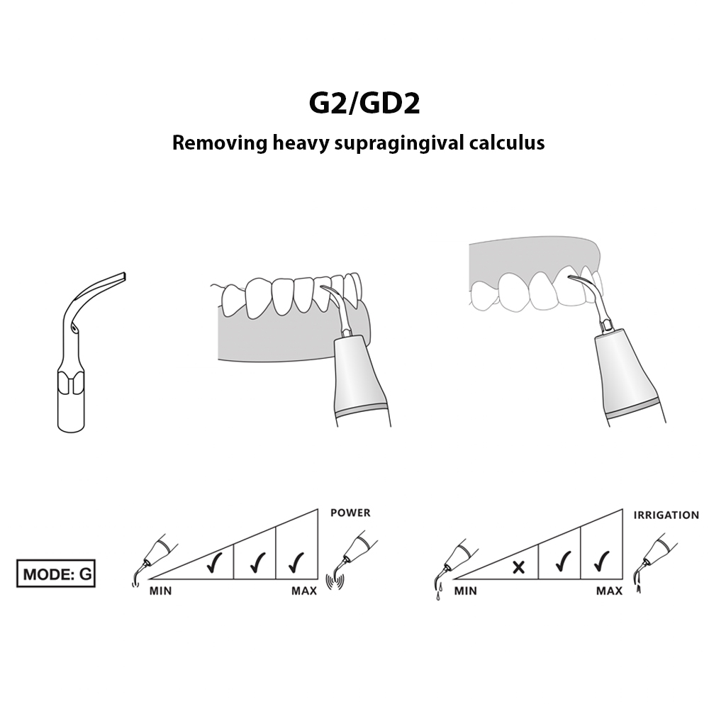 Woodpecker Scaler Tip GD2 for DTE & Satelec Scalers