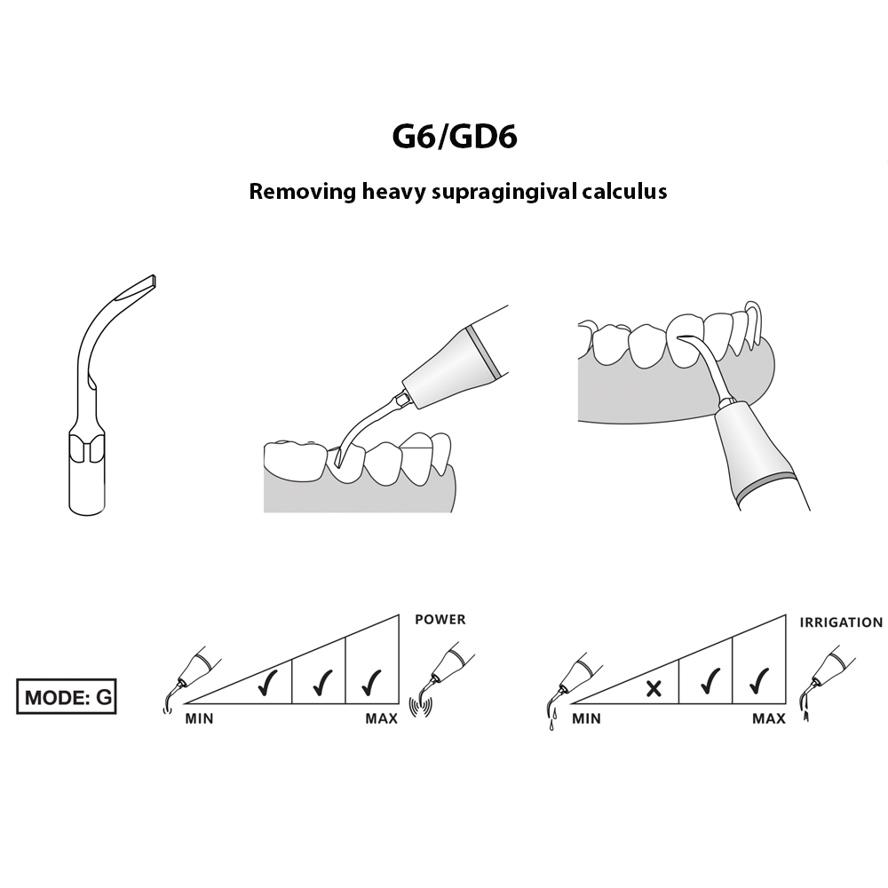 Woodpecker Scaler Tip GD6 for DTE & Satelec Scalers