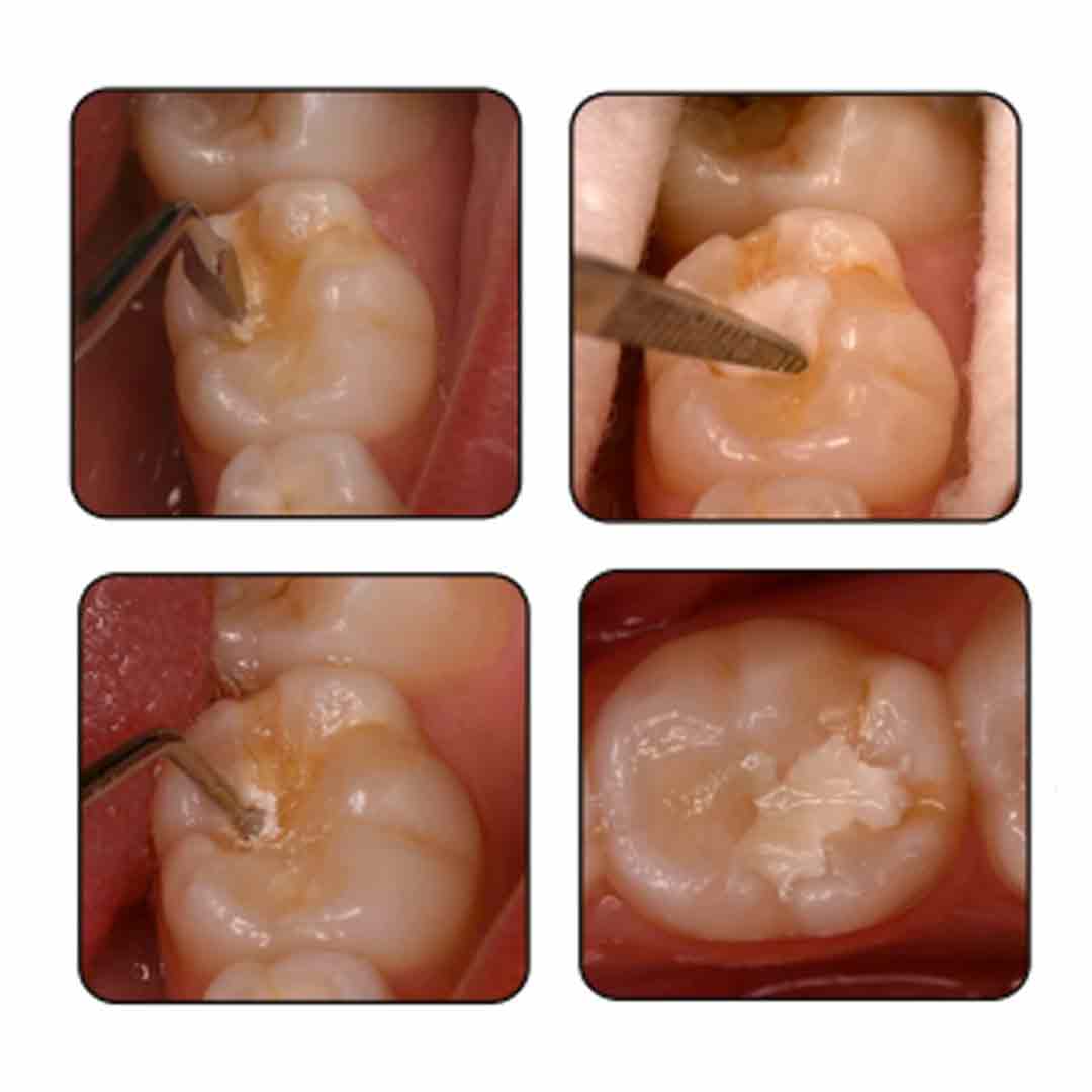 GDC ART Instruments Set of 5