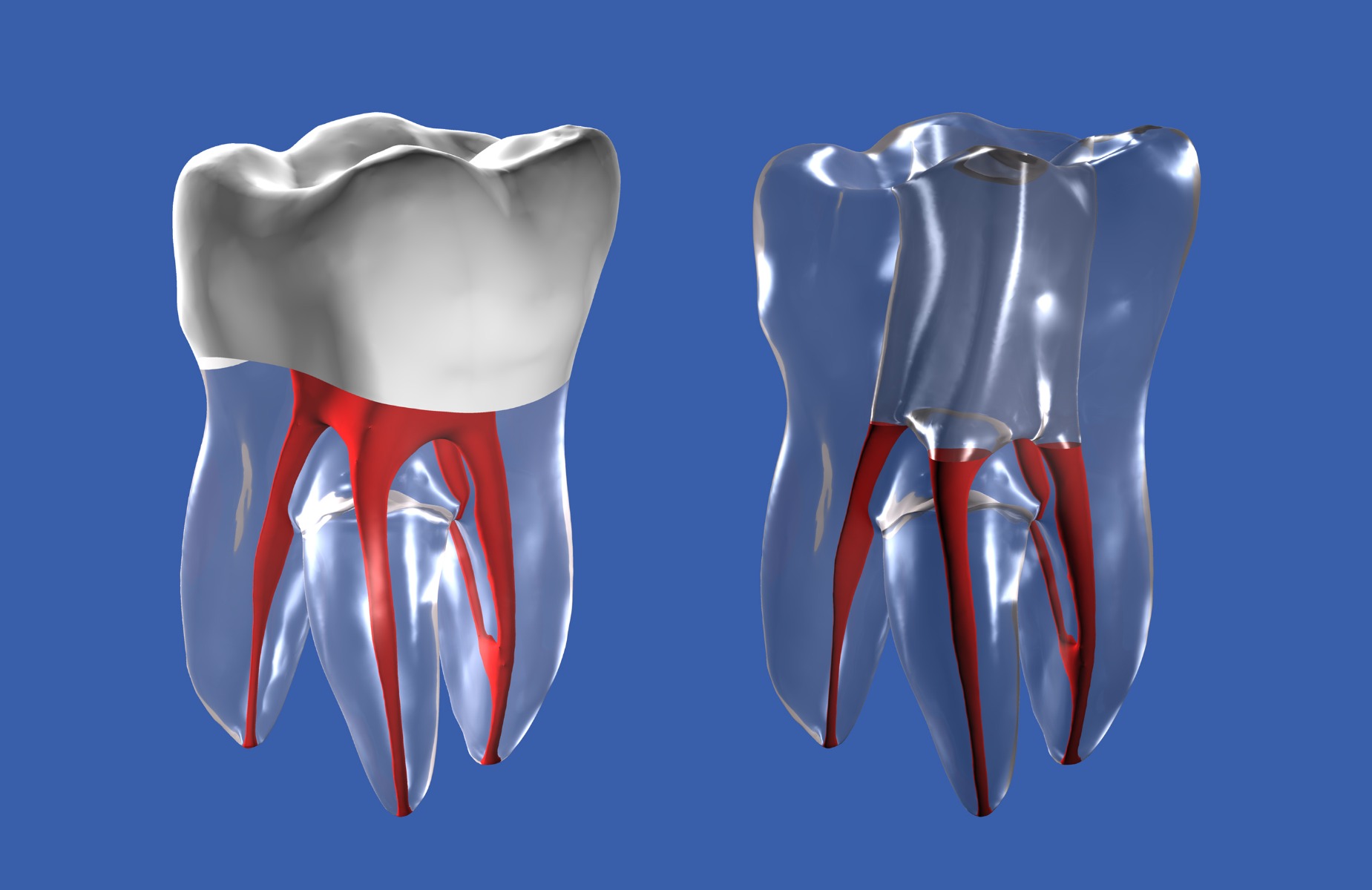 iDENTical Root Canal (RCT) Practice Tooth Model - M8008