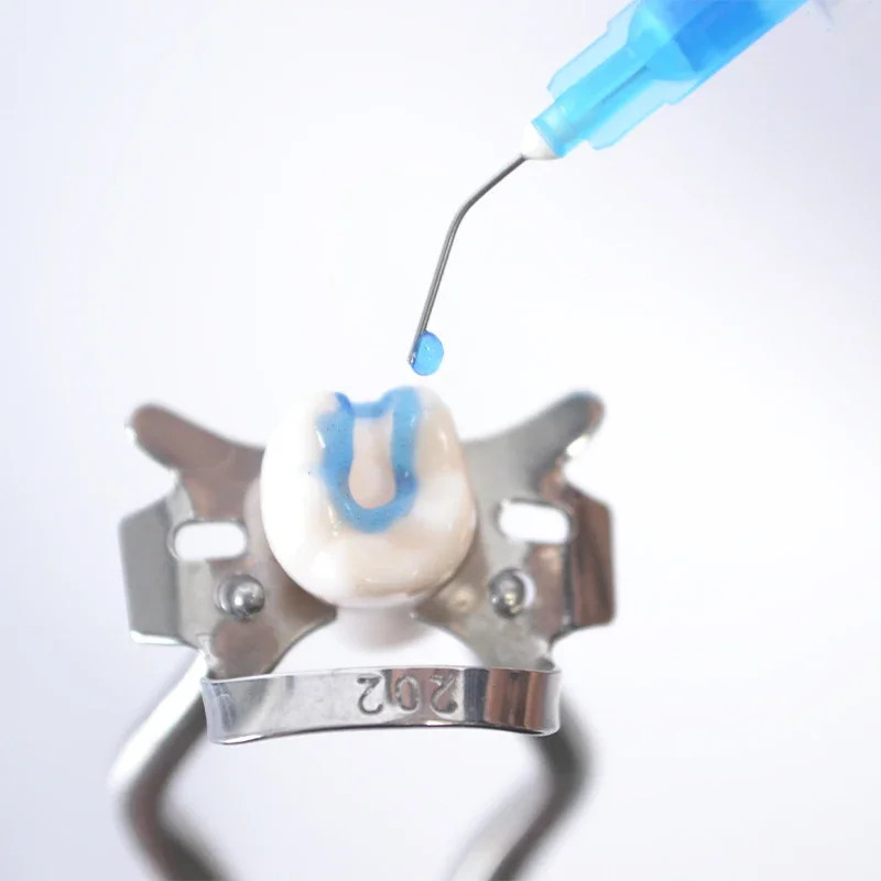 Anabond Eazetch Etchant Gel