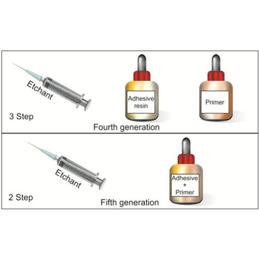 Waldent NanoBond Universal Adhesive