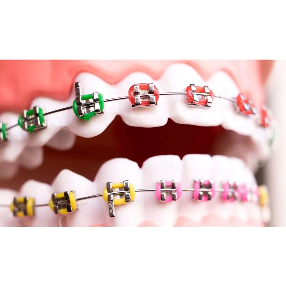 Koden Preformed TMA Archwires - Rectangular (Pack of 2)