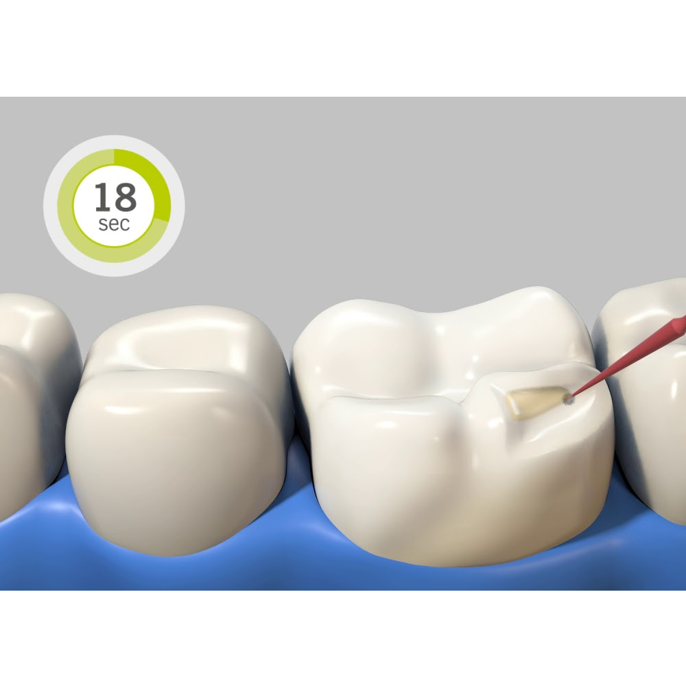 Kulzer Charisma Classic Composite Restorative Kit- With Gluma Bond Universal