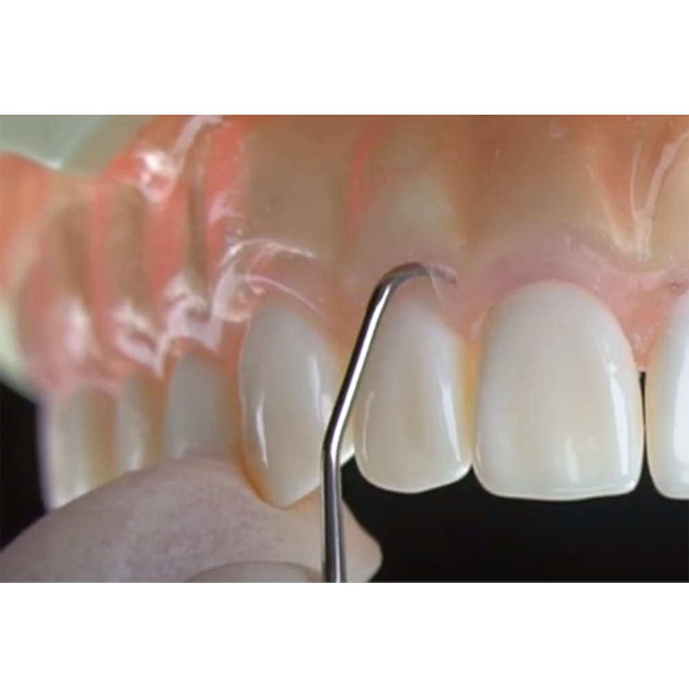 GDC Gracey Curettes Cc Anterior Incisors And Canines # 7 (Sgcc1/2)