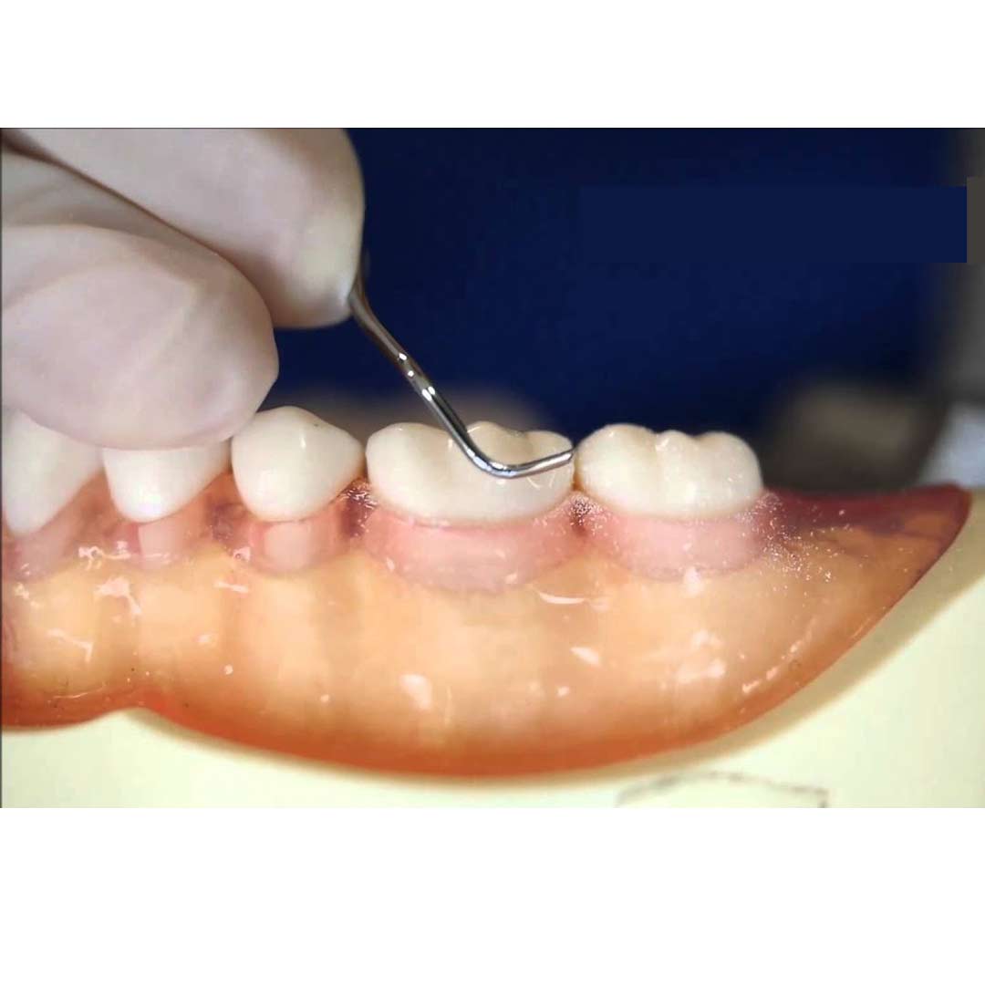 Waldent Periodontal Kit Set of 15 (K15/6)