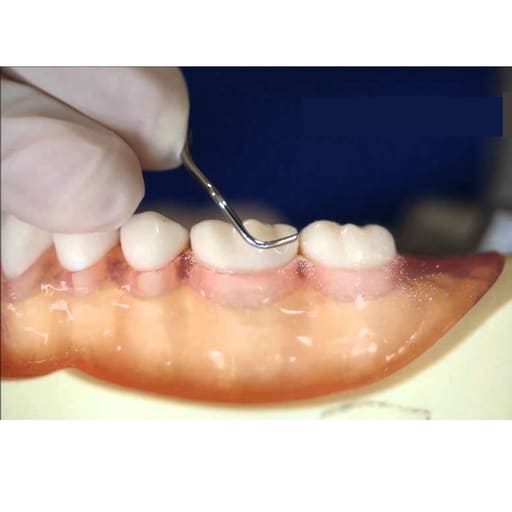 Waldent Periodontal Kit Set of 15 (K15/6)