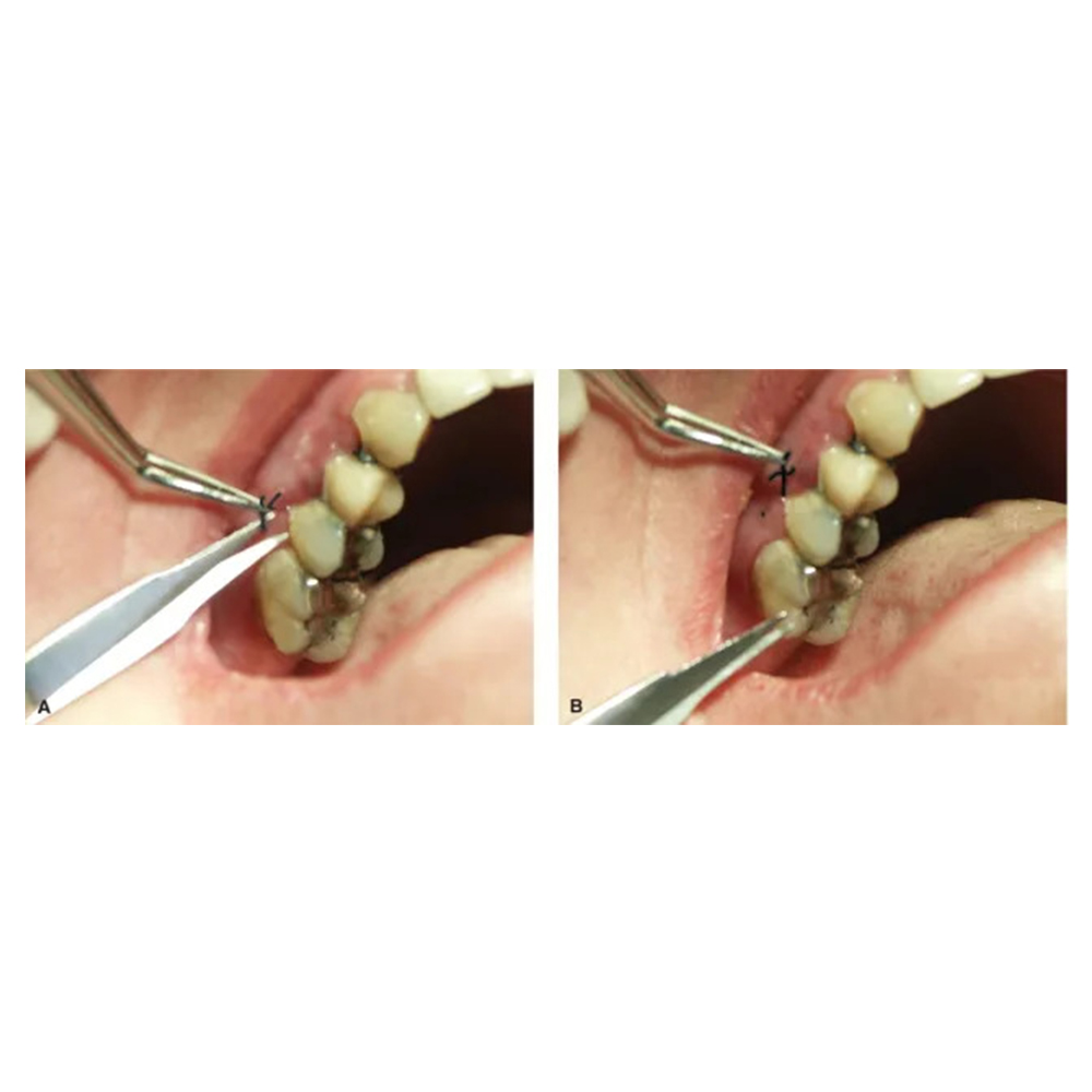 Julldent Goldman Fox Scissors