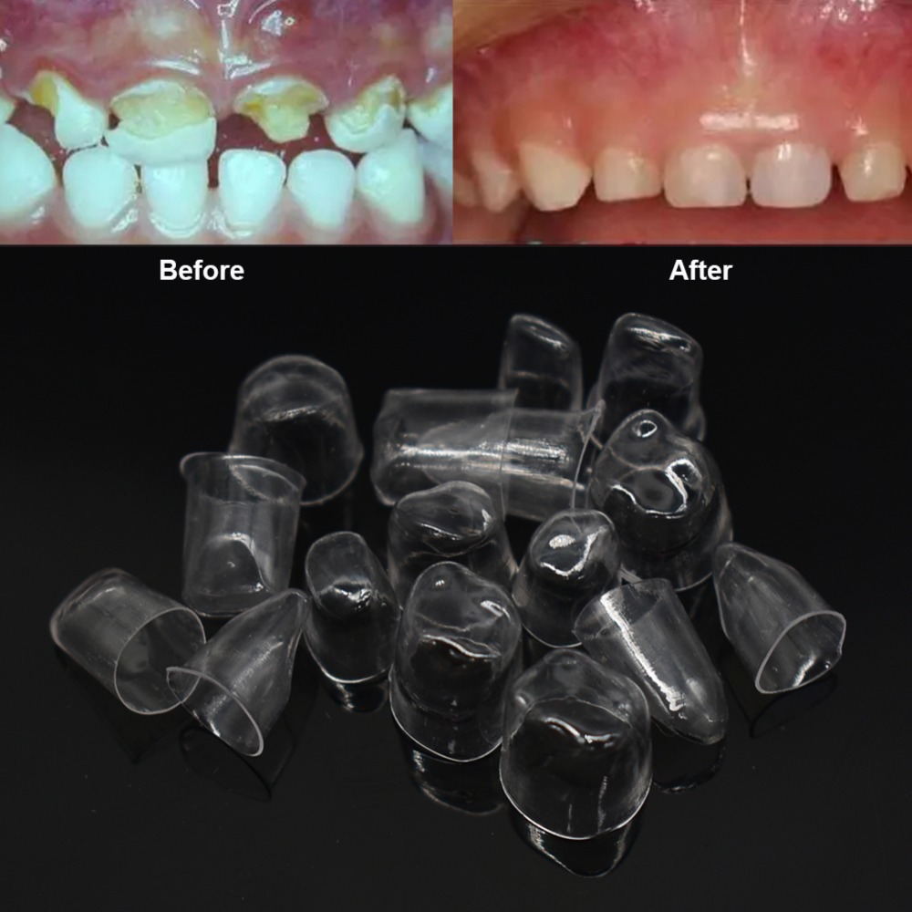 Tor Vm Transparent Crowns 64 pcs - Anterior No. 1.910