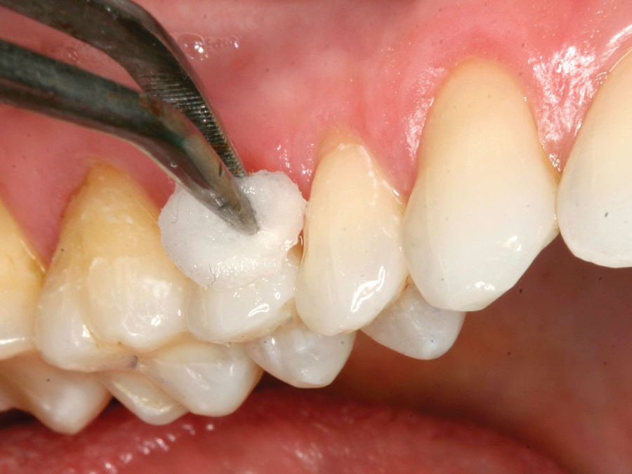 Maarc D-Sens G+ (3019/002)