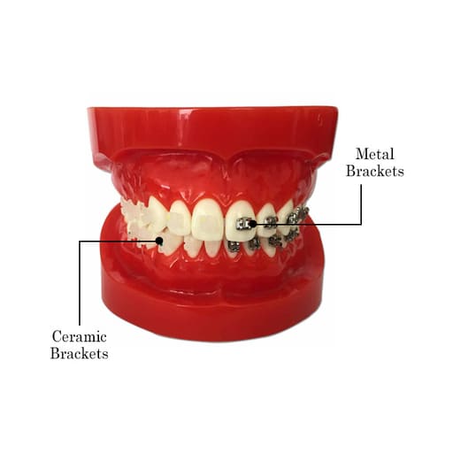 iDENTical Half Metal and Half Ceramic Brackets Orthodontic Models M3003