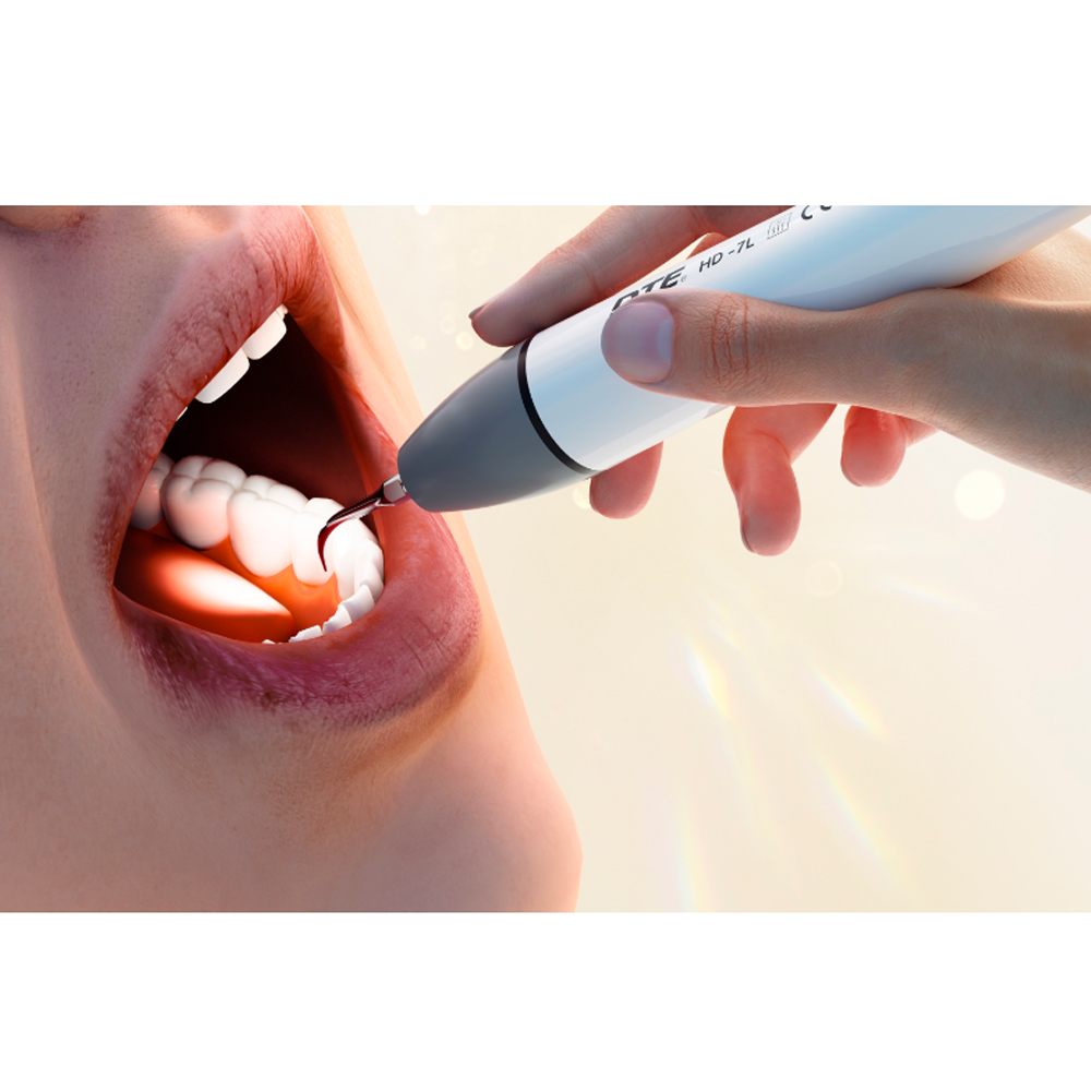 Woodpecker Ultrasonic Scaler Handpiece - HD 