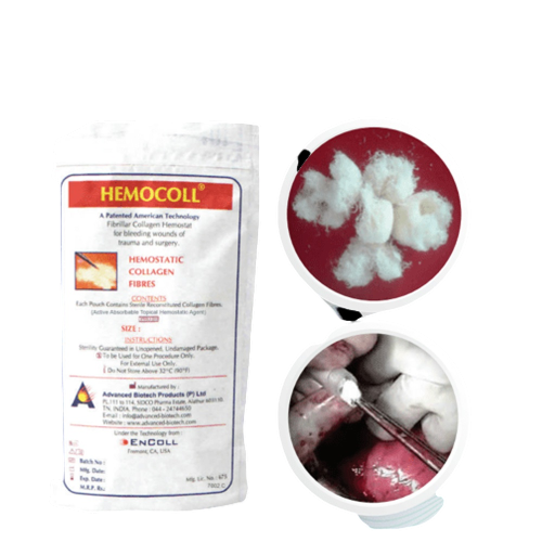 Advanced Biotech Hemocoll