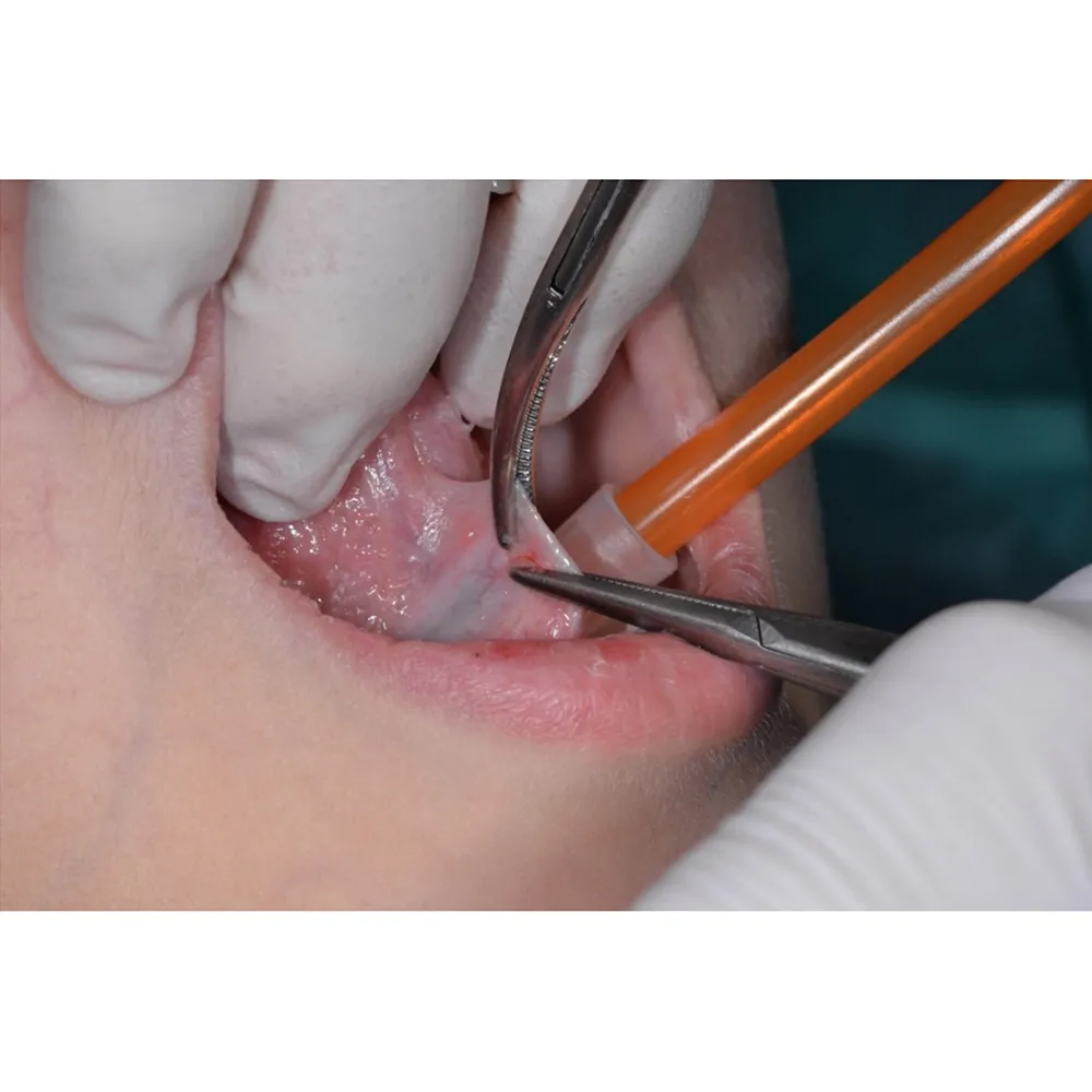 GDC Hemostats Baby Mosquito Curved - (10cm) (Hhc)