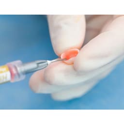 Vincismile HF-Etchant Hydrofluoric Acid Etching Gel - 2