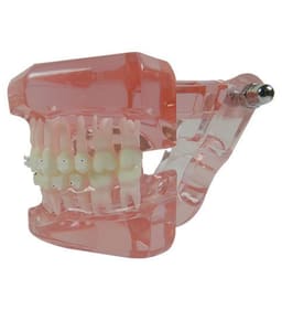 iDENTical Half Metal and Half Ceramic Brackets Orthodontic Models M3003 - 6
