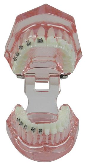 iDENTical Half Metal and Half Ceramic Brackets Orthodontic Models M3003