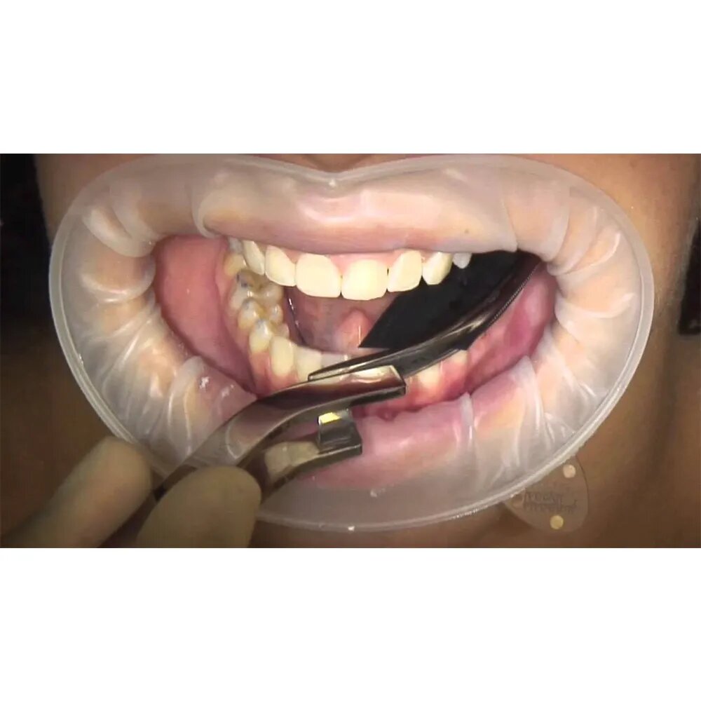 Oracraft Dental Articulating Paper Holder Miller Curved - APF2C