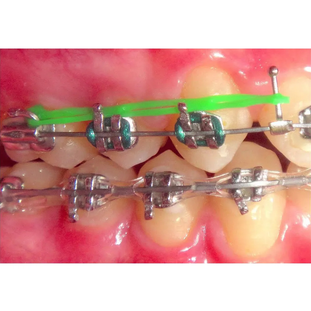 Koden Crimpable Ball Hooks (Pack of 10)