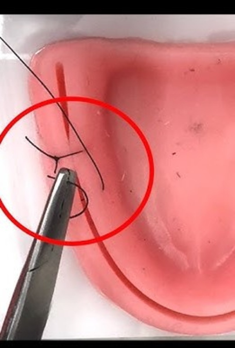 Ethicon Mersilk #3-0 Black Braided Suture