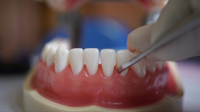 GDC Sub Gingival Scalers S/7 Instruments Kit (SGSP7)