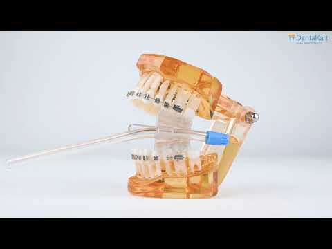 Mouth Prop with Suction Attachment - 2