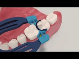 Polydentia MyClip 2.0 Secional Matix System Kit - 2