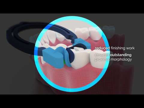 Polydentia MyQuickmat Forte Secional Matrix System Kit & Refills - 2