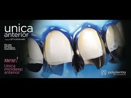 Polydentia Unica Anterior Matrix System Kit & Refills - 2